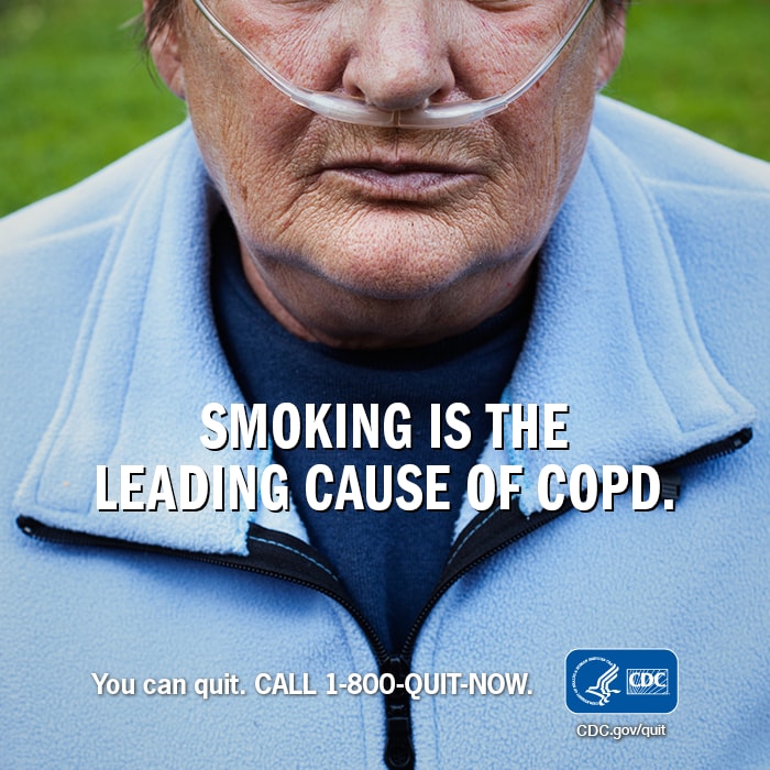 Smoking is the leading cause of COPD. You can quit. CALL 1-800-QUIT-NOW.