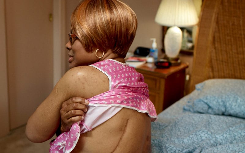 Annette, 57 años, Nueva York; se le diagnosticó cáncer de pulmón a los 52 años