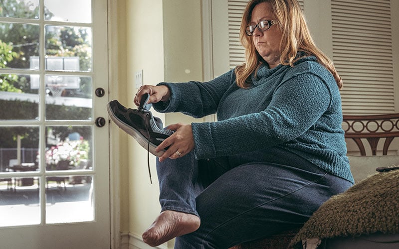 Rebecca C., age 43, had all five toes on her right foot amputated because of Buerger’s Disease