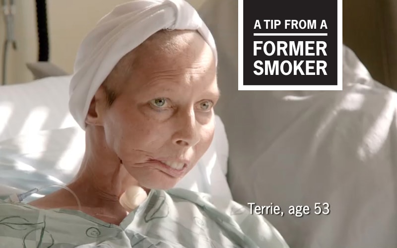 Terrie’s “Surgeon General” Tips Commercial - A Tip From A Former Smoker