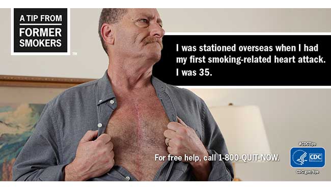 Brian H. - I was stationed overseas when I had my first smoking-related heart attack. I was 35.