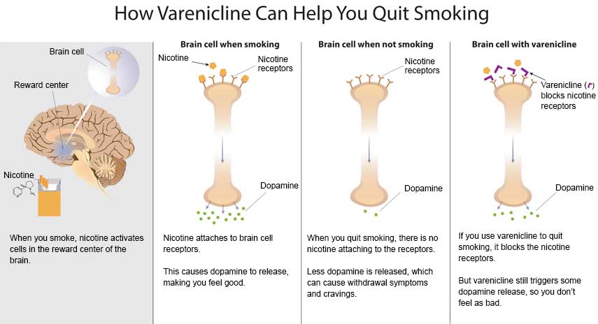 How varenicline can help you quit smoking - Slide 1 - When you smoke, nicotine activates cells in the reward center of the brain (Brain cell illustration, illustration of brain with Reward center, illustration of cigarettes with nicotine pointing to it) Slide 2 - Illustration of a brain cell when smoking showing nicotine, nicotine receptors and dopamine.  Nicotine attaches to brain cell receptors.  This causes dopamine to release, making you feel good. Slide 3 - Illustration of brian cell when not smoking. Showing nicotine receptors and dopamine response Slide 4 - Illustration of Brian cell showing how varenicline blocks nicotine receptors and how dopamine responds.  If you use varenicline to quit smoking, it blocks the nicotine receptors.  But varenicline still triggers some dopamine release, so you don't feel as bad.