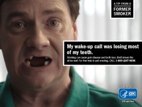 A Tip From a Former Smoker: My wake-up call was losing most of my teeth. Smoking can cause gum disease and tooth loss. Brett knows this all too well. For free help to quit smoking, call 1-800-QUIT-NOW.