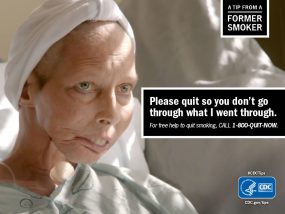 A Tip From a Former Smoker: Please quit so you don't go through what I went through. For free help to quit smoking, call 1-800-QUIT-NOW.