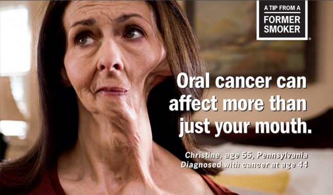 Christine's Tips: Oral Cancer