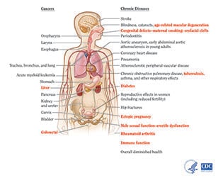 Health Effects of Cigarette Smoking | CDC
