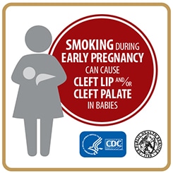 Smoking during early pregnancy increases a baby's risk for cleft lip and/or cleft palate