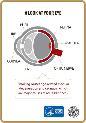 Adult Blindness and Smoking