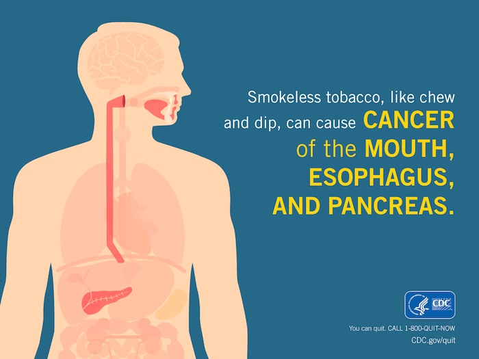 Image of a body in silhouette with text: Smokeless tobacco, like chew and dip, can cause cancer of the mouth, esophagus, and pancreas; Information/description of this infographic provided below.