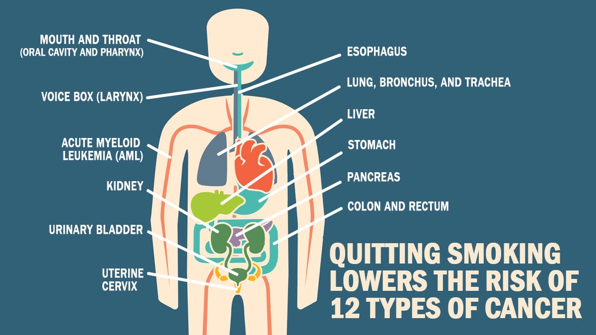 Human body labeled with the 12 areas that cancer risk can be reduced by quitting smoking.