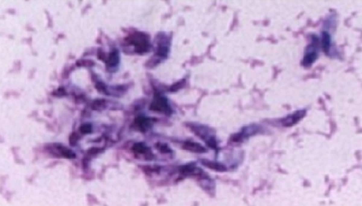 Toxoplasma gondii a single-celled parasite.