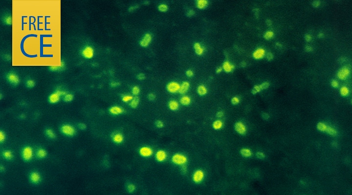 Photomicrograph of a tissue sample that shows numerous Haemophilus influenzae bacteria
