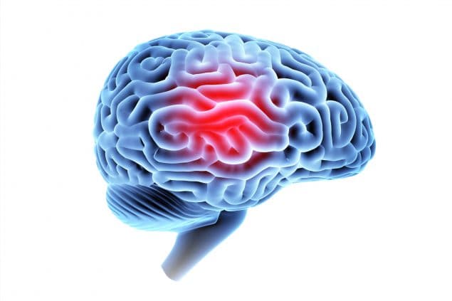 CGI of brain