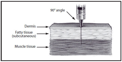 Im Needle Size Chart