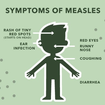 Symptoms of measles.