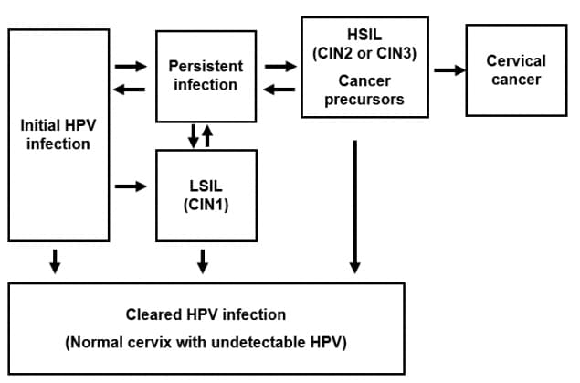 Pathogenesis of HPV Infection and Cervical Cancer flow chart as discussed in text
