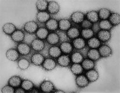 Intact rotavirus, double-shelled particles under transmission electron microscope.