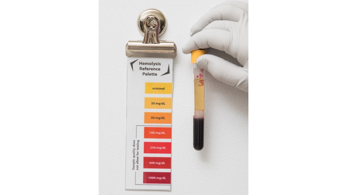 A lab technician wearing gloves holds a tube adjacent to the Hemolysis Reference Palette to determine status.
