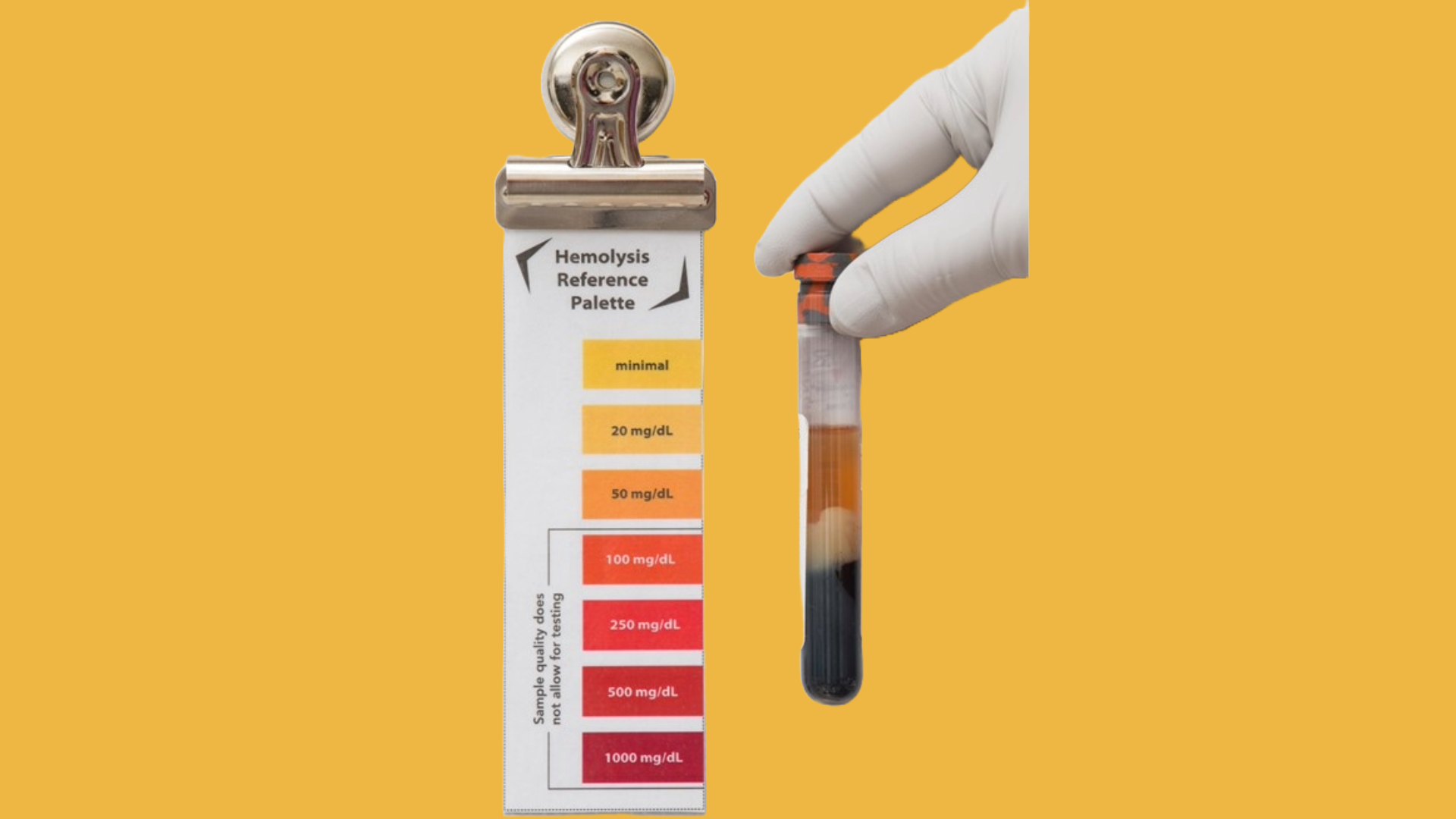 A lab technician wearing gloves holds a tube adjacent to the Hemolysis Reference Palette to determine status.