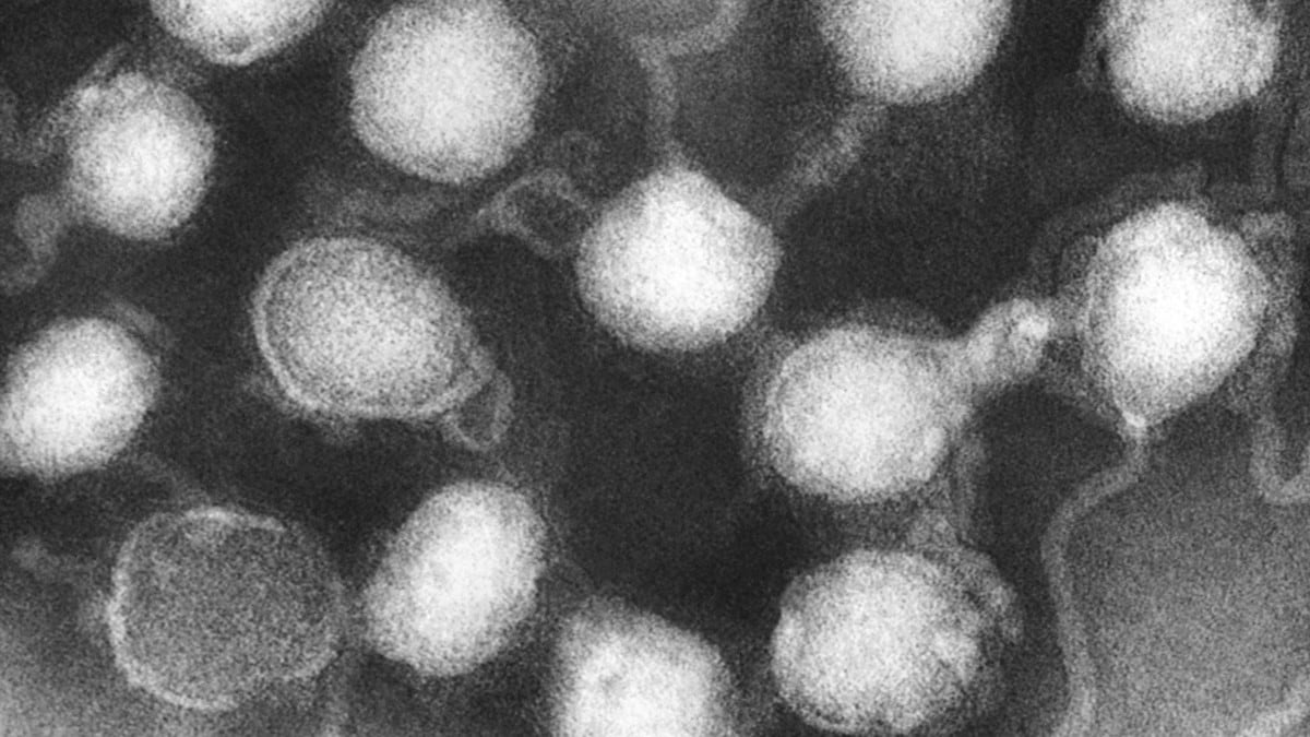 La Crosse virus transmission electron microscopic image
