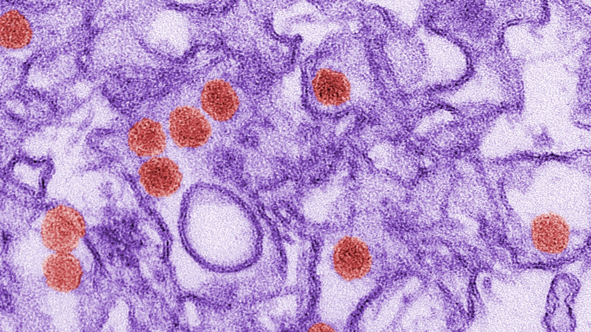 Zika virus digitally colorized transmission electron microscopic image