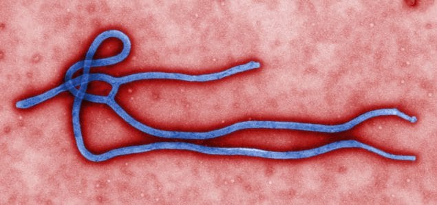 Colorized transmission electron micrograph (TEM) of ebola virus virion