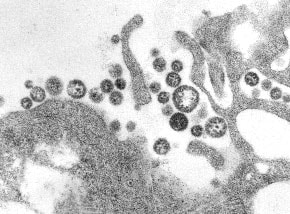 Photo of Lassa virus sample