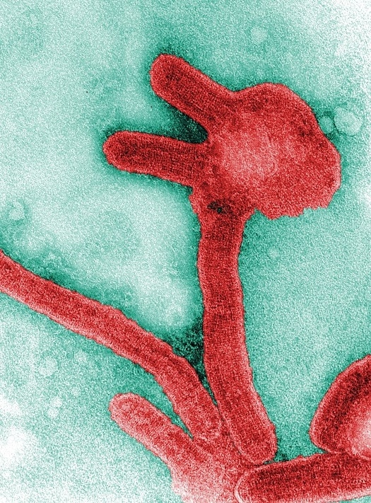 Electron microscopic image depicting a number of Marburg virus virions.