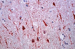 Nipah virus infection in human central nervous system tissue specimen, credit to CDC PHIL