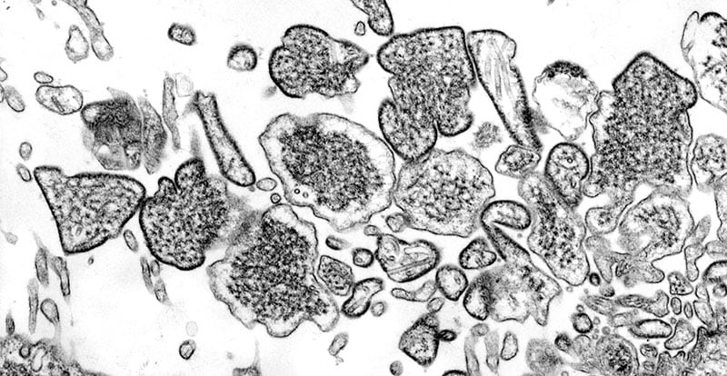 Electron micrographic image of Nipah virus