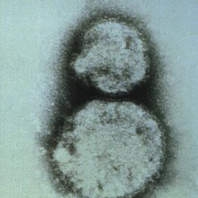 The Arenaviridae are a family of viruses whose members are generally associated with rodent-transmitted diseases in humans.
