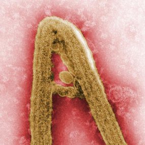 Colorized negative stained transmission electron micrograph depicting a Marburg virus virion, in the filovirus family.