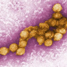 Digitally-colorized transmission electron micrograph of the West Nile virus, in the flavivirus family.