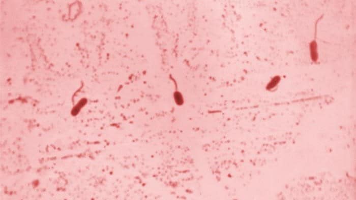 A photomicrograph of a gram-stained specimen, revealing four Vibrio bacteria with visible tails.