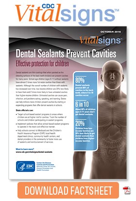 Download Factsheet: Dental Sealants