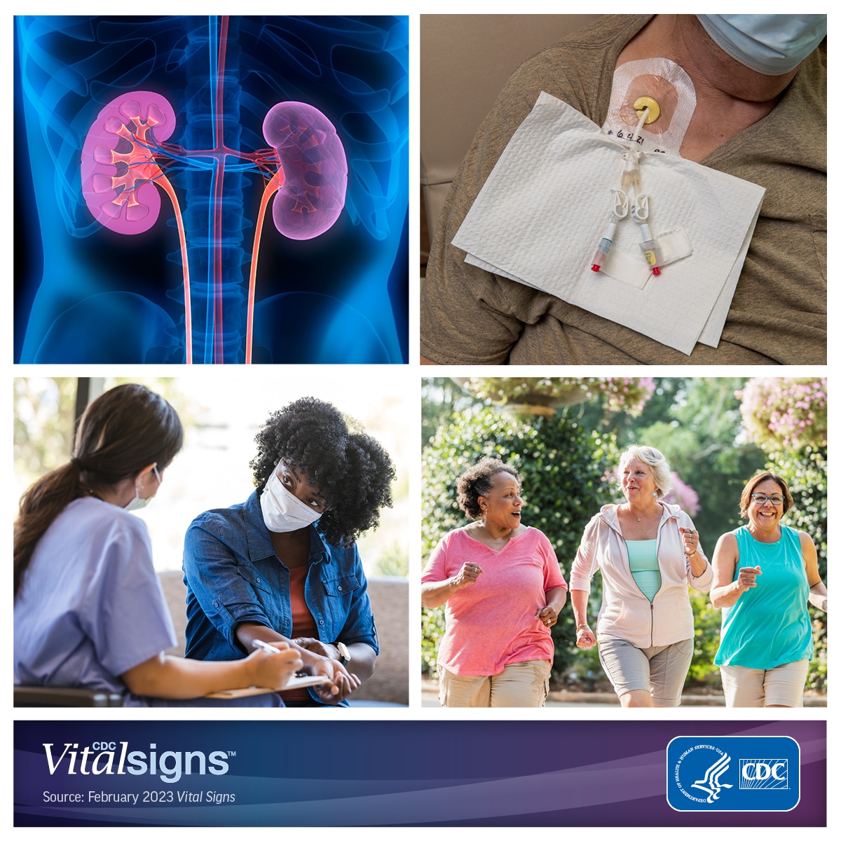 Photo collage of kidneys, patient set up for dialysis, nurse asking a patient questions, and a trio of women jogging.