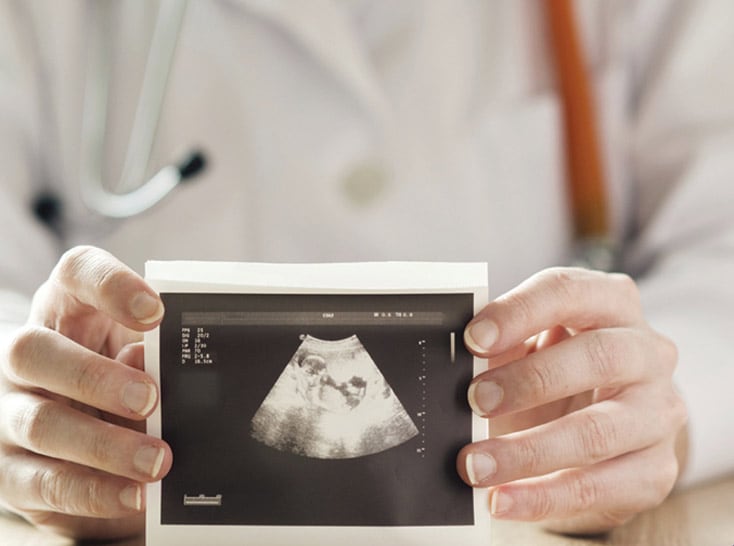 Doctor holding an ultrasound picture