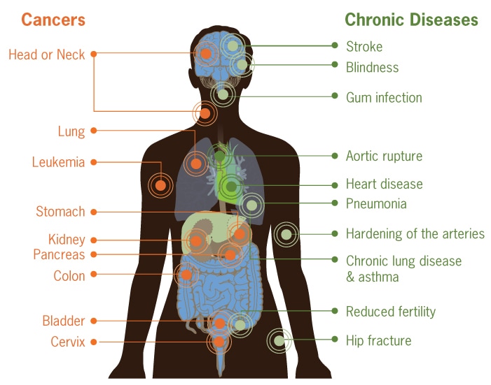 This image is illustrates how smoking can damage every part of the body.  The image show an outline of a human body. Internal organs are visible, and circles mark the locations where smoking causes damage.  On the left side of the body, the following locations and organs are marked with circles to identify cancers caused by smoking: Head or neck, lung, stomach, kidney, pancreas, colon, cervix, and bladder.  On the right side of the body, the following locations and organs are marked with circles to identify chronic diseases caused by smoking: stroke, blindness, gum infection, aortic rupture, heart disease, pneumonia, hardening of the arteries, chronic lung disease/asthma, reduced fertility, and hip fracture.