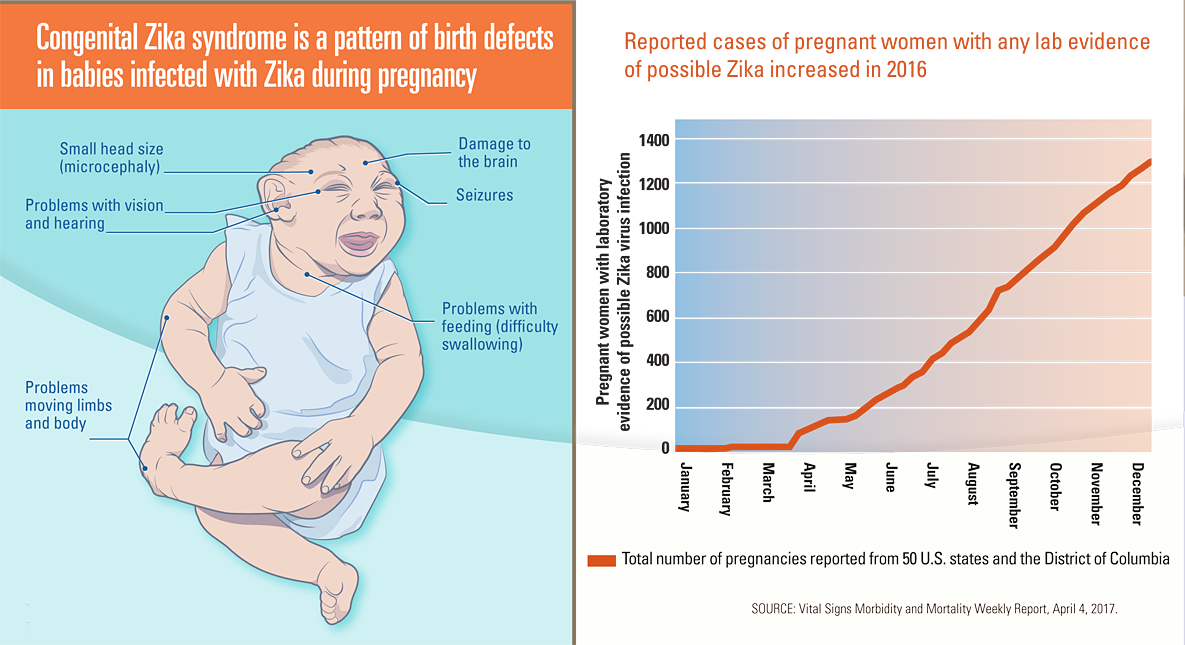 Left Graphic: This graphic is a drawing of a baby with birth defects caused by congenital Zika syndrome. Right Graphic: This graphic shows that the number of reported cases of pregnant women with any evidence of possible Zika increased in 2016 from January through December