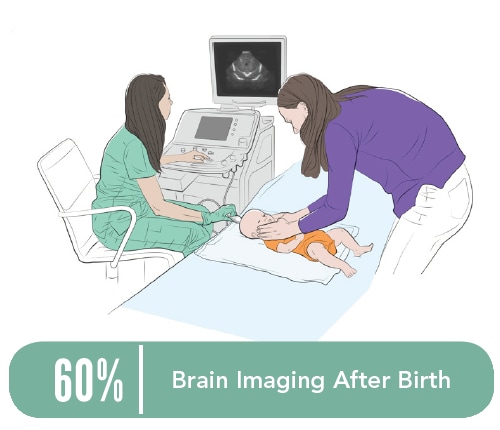 Illustration of a healthcare professional conducting a brain imaging test on a baby as the mother holds the baby’s head in place.