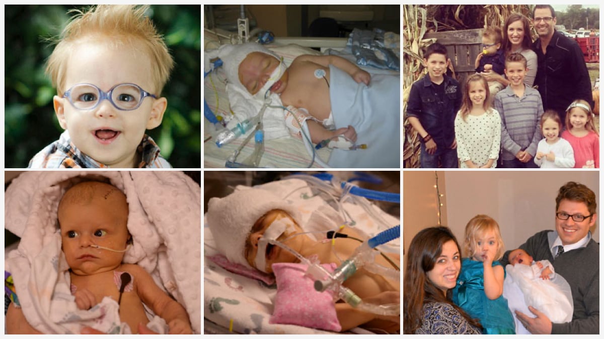 An image collage of people affected by vitamin k deficiency bleeding