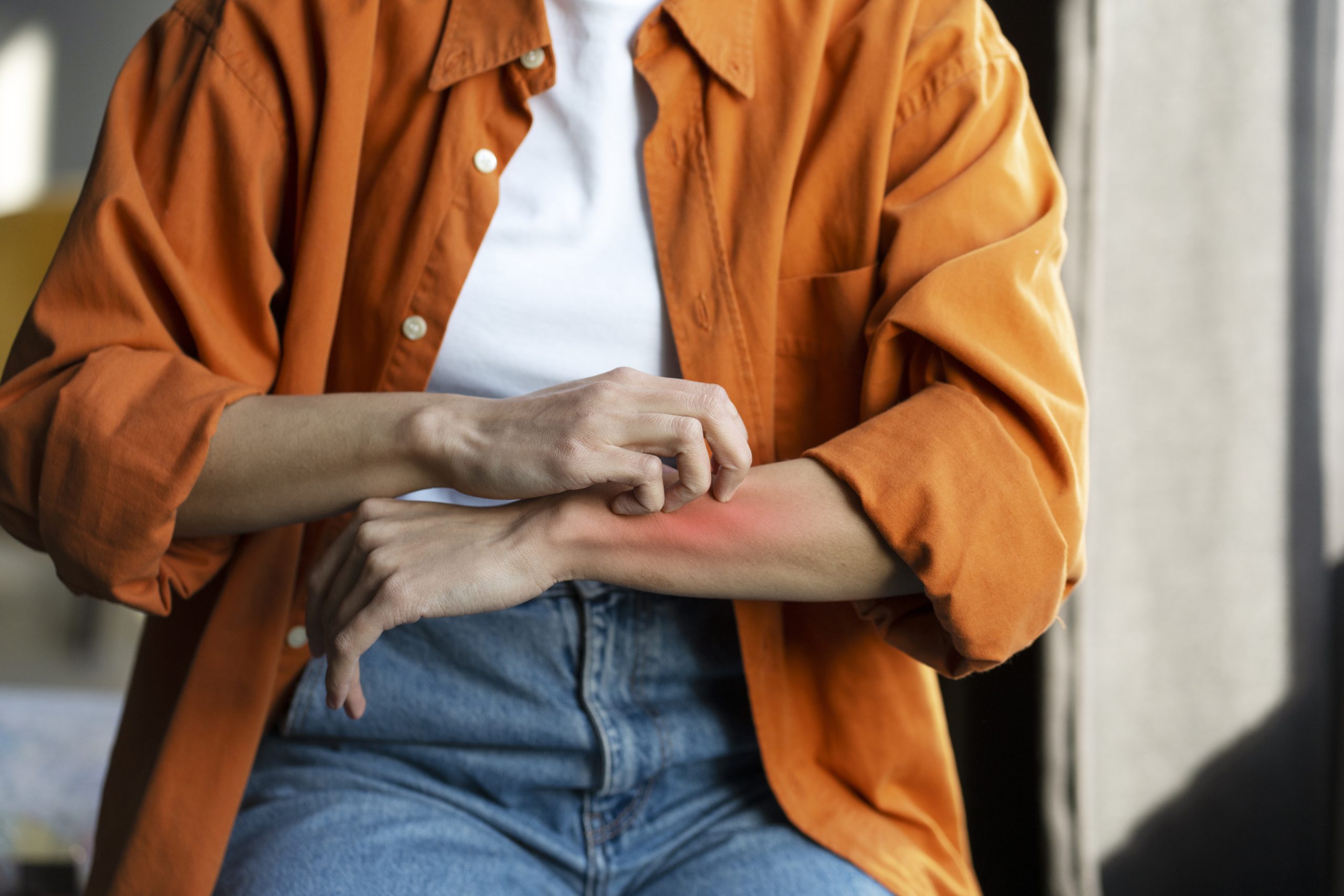Post-Travel Dermatologic Conditions | Yellow Book Post-Travel Dermatologic Conditions | Yellow Book