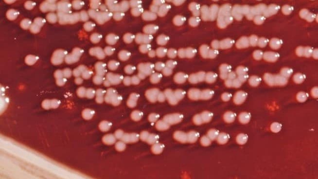Colonial growth pattern displayed by Gram-negative Yersinia enterocolitica bacteria.
