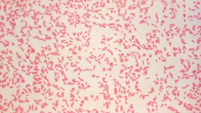 Photomicrograph showing a field of numerous Gram-negative, rod-shaped Yersinia enterocolitica bacteria.