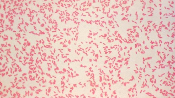 Photomicrograph showing a field of numerous Gram-negative, rod-shaped Yersinia enterocolitica bacteria.