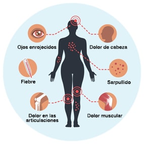 Síntomas del virus del Zika
