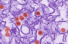 digitally-colorized transmission electron micrograph (TEM) of Zika virus