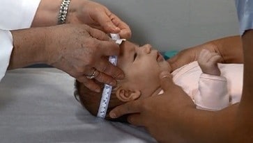 Picture of doctor measuring head circumference of an infant.