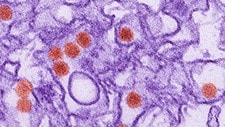 A digitally-colorized transmission electron micrograph (TEM) of Zika virus