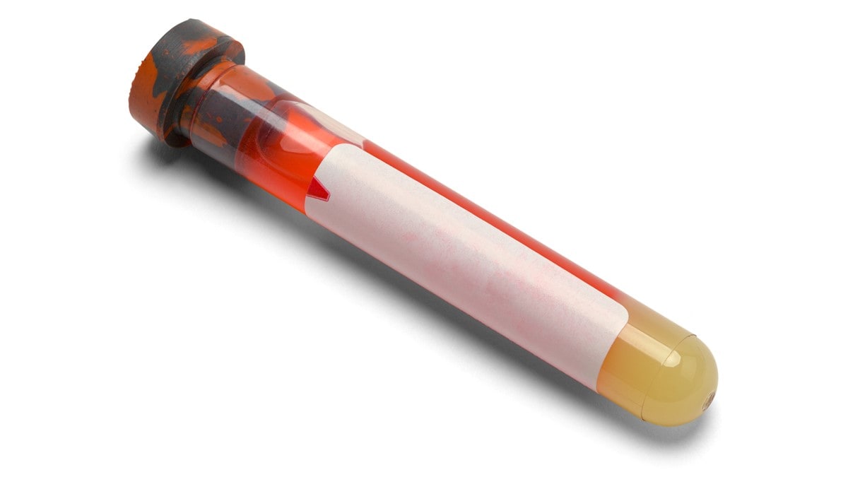 A testing vial of blood.